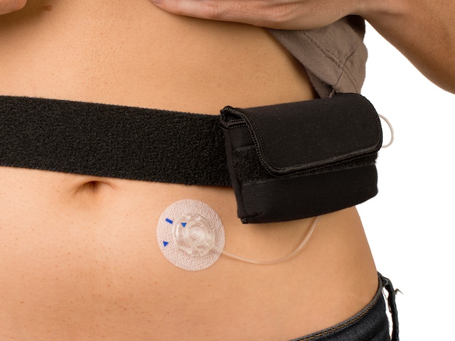 Medtronic ACC-255BK Чехол для помпы на бедро / талию ( MMT-515 / MMT715 )